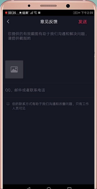 在抖音里怎么聯系客服？聯系客服的方法說明