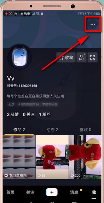 抖音如何找到反饋？ 抖音找到反饋方法攻略解答！